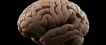 Sleep Deprivation and Brain Health: The Impact on Brain Volume
